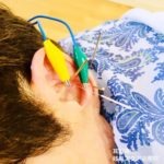 岐阜市で肩関節痛、五十肩、ぎっくり腰、坐骨神経痛、捻挫の痛み、急性の痛みにBattlefield Acupuncture 戦場鍼治療をお薦めします。