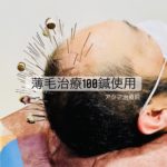 薄毛でお悩みの方、100本の鍼使用する頭皮鍼をお試しください。