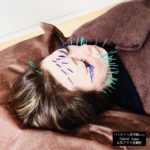 美容鍼、美顔鍼、100本の鍼、年齢肌、フェイスラインの弛みが気になるならアクア治療院へ