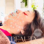 女性の美を追求する美容鍼はHarist_Aquaから…