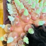 全身MEGA盛りDetoxカッピングは、アクア治療院で施術いたします。