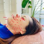 肌質改善、弛みケアならアクアのハリもぐら美容鍼100