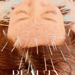 岐阜市で美容鍼100本を受けるならアクア治療院へ