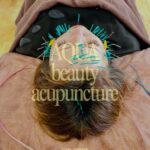 100本の美容鍼に、口角を引き上げる電気を流す。